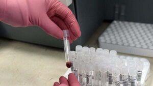 Number of people living with HIV in Ireland increases to 100 cases per month