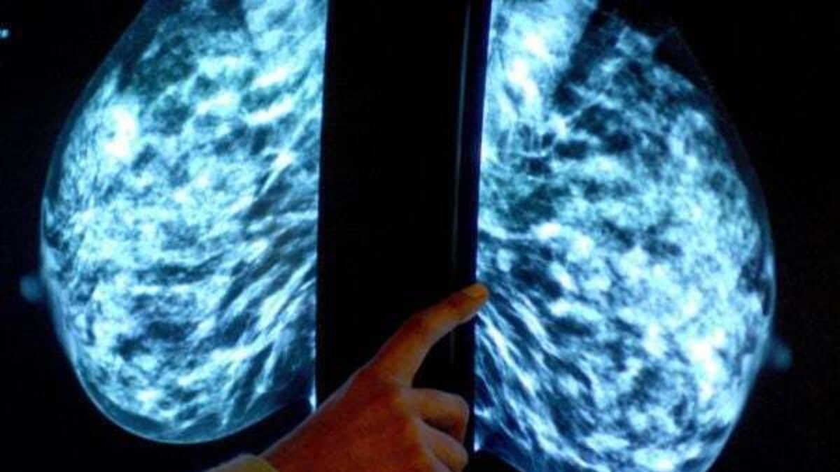 Widower settles action against HSE over death of wife from breast cancer