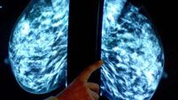 Widower settles action against HSE over death of wife from breast cancer