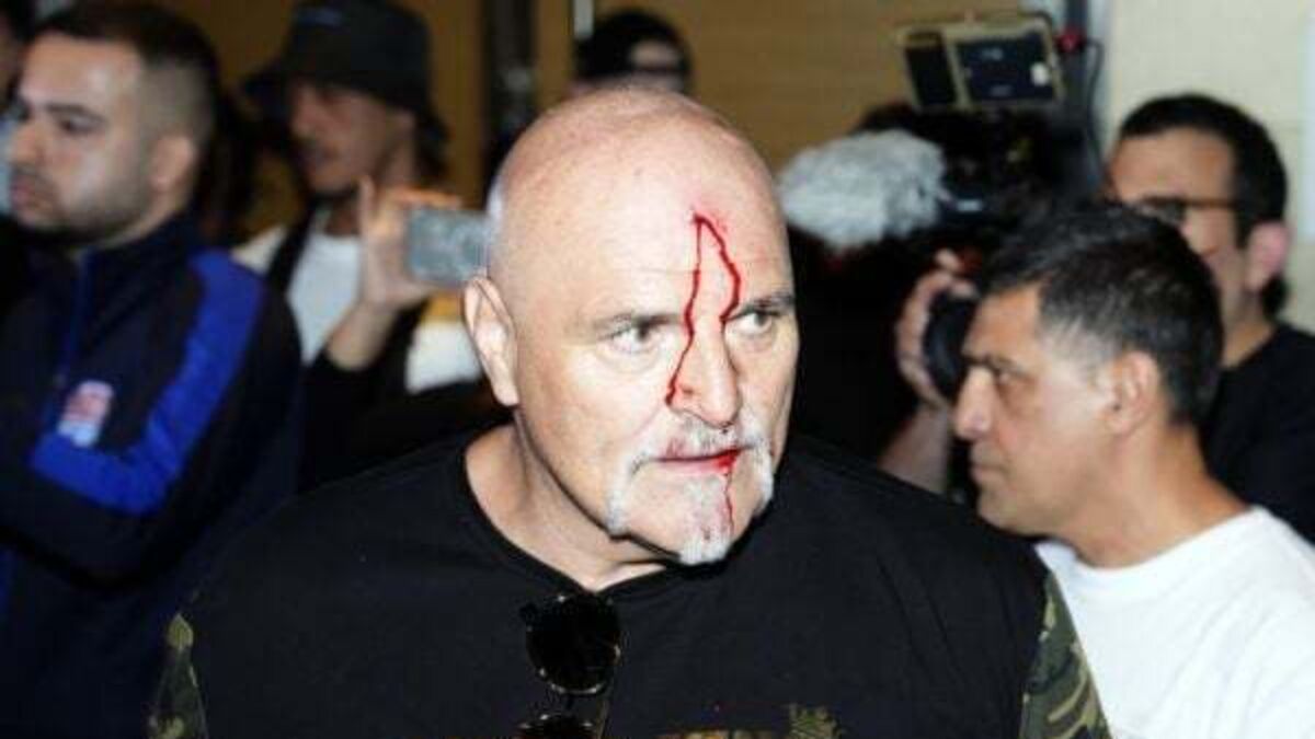Tyson Fury’s father John suffers cut to head as Oleksandr Usyk fight week begins