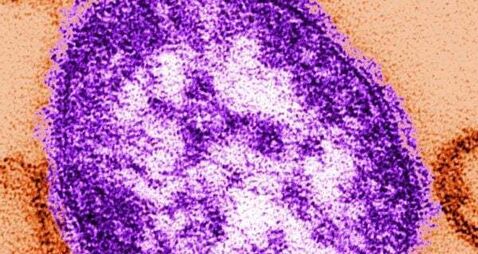 Passengers on Dublin to Tipperary bus exposed to measles