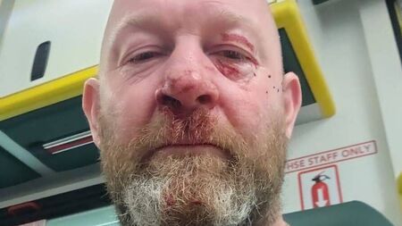 Coach headbutted by parent at U12 game