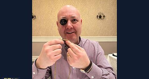 Gold teeth complete with roots sold as people cash jewellery in