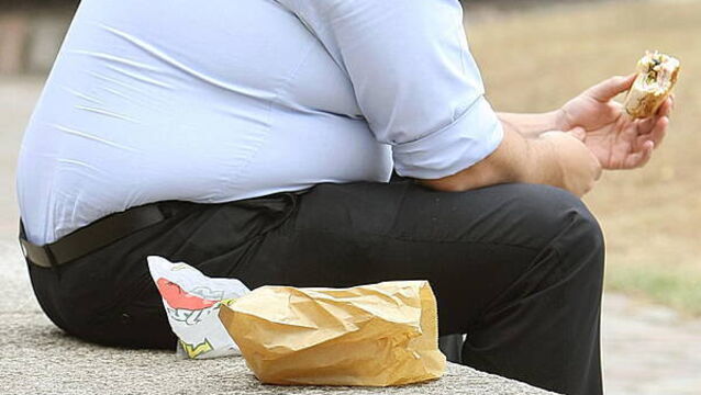 Irish public ‘least likely to blame environmental factors for obesity epidemic’
