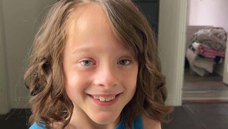 Roxanne’s spinal surgery in the USA was a big success 